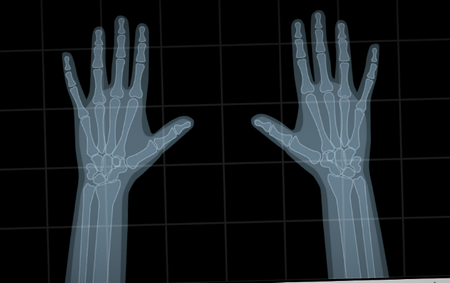 奇案炼金术士Alchemist 奇案炼金术士Alchemist